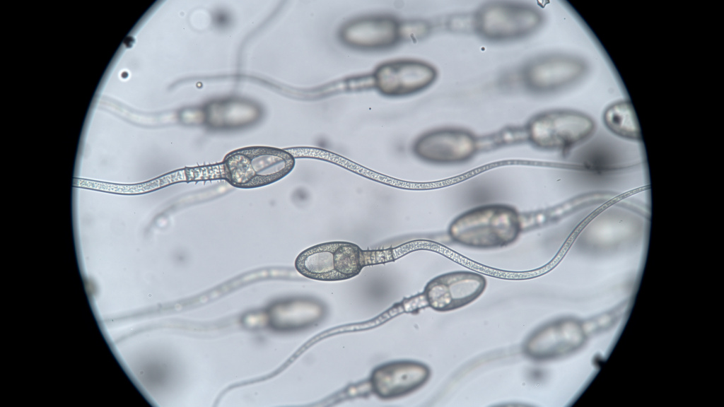 Microscopic view of sperm cells for fertility analysis