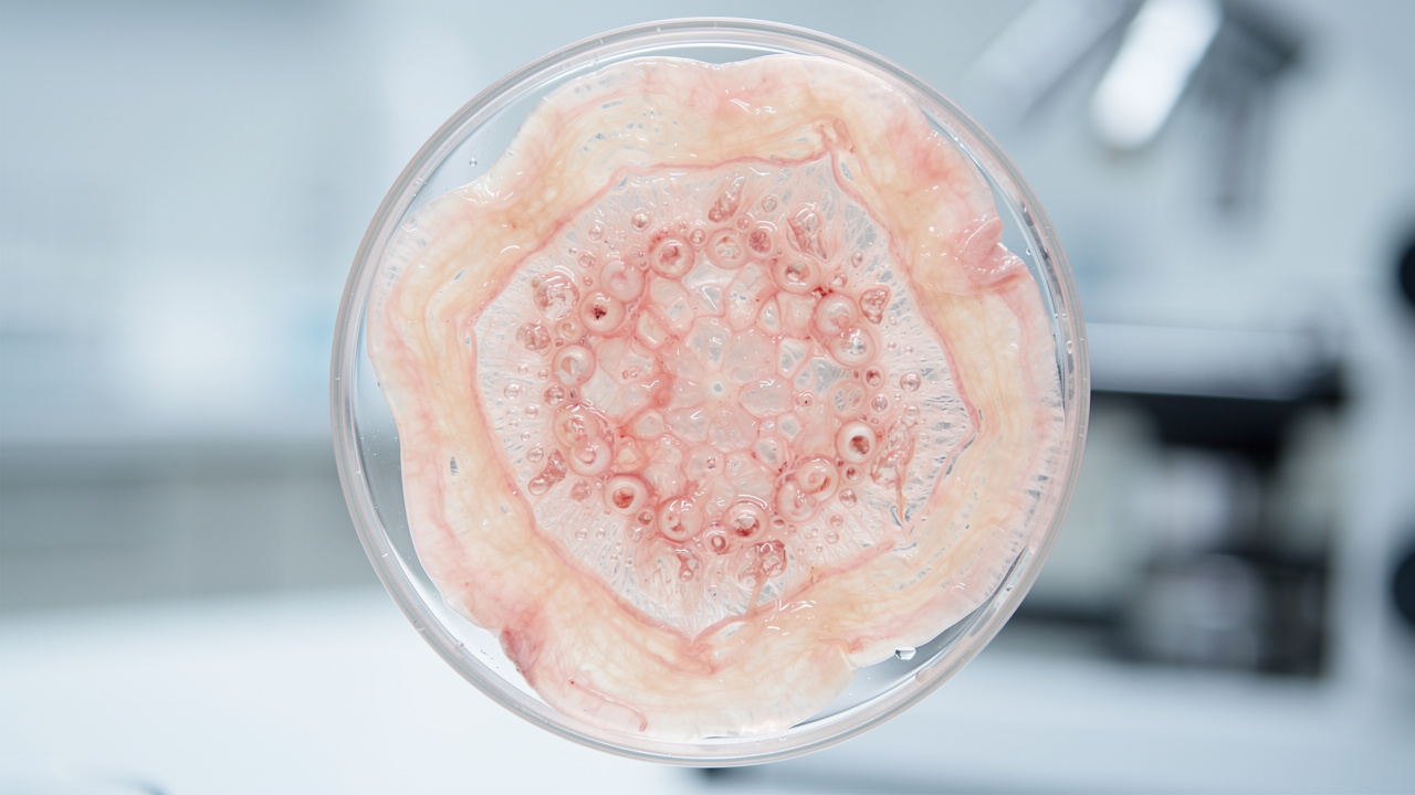 Ovarian tissue showing healthy follicles