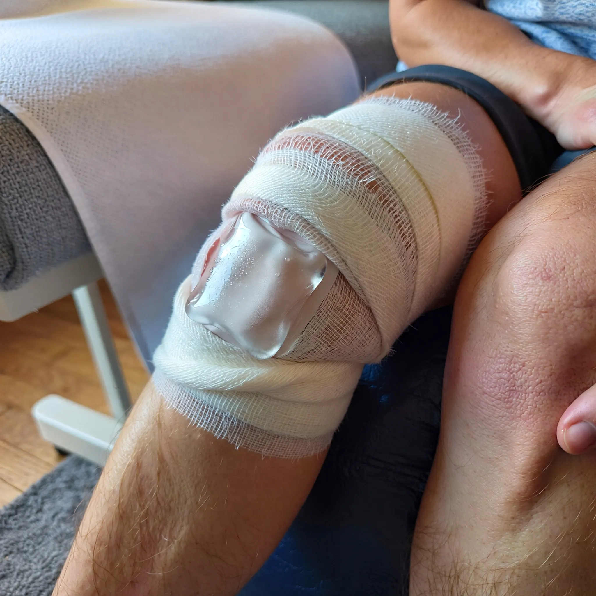 Kojąca przestrzeń terapeutyczna z zimnym okładem na kolanie, podkreślająca znaczenie leczenia niefarmakologicznego.