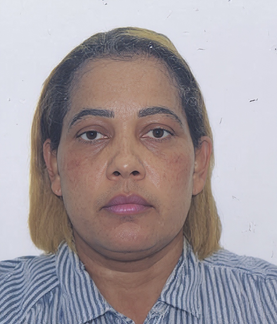 mejora-la-resolucion-ozc7unvpzv