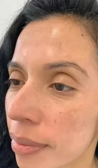 Avis Zero Pore Pad ROSELYNA