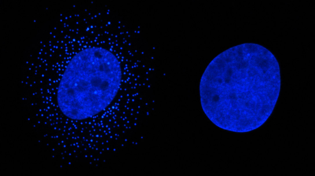 Fluorescence DAPI : cellule avec foyers d'ADN mitochondrial, et cellule sans