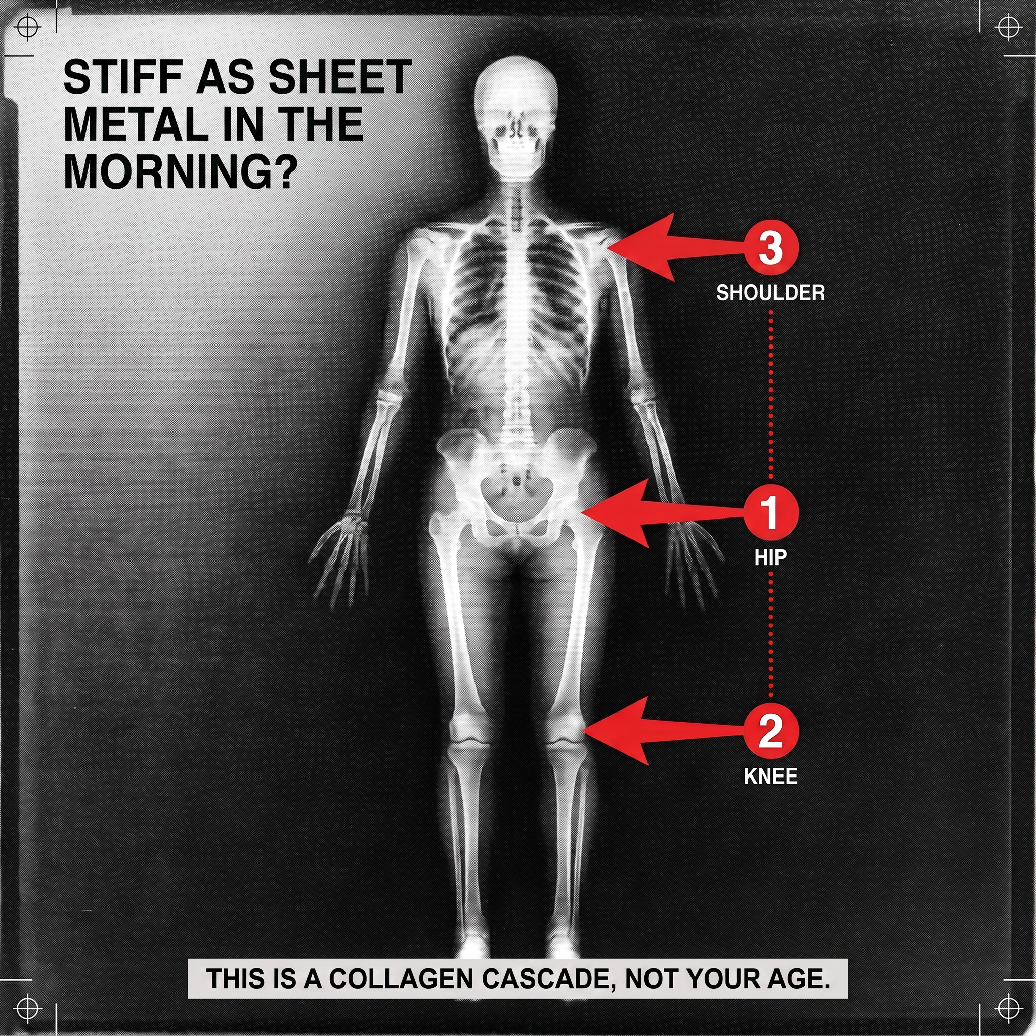 Collagen cascade, hip, knee and shoulder marked with three red arrows on an X-ray